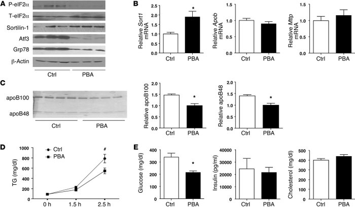 Expression of sortilin-1 was increased by suppression of ER stress.
8- t...