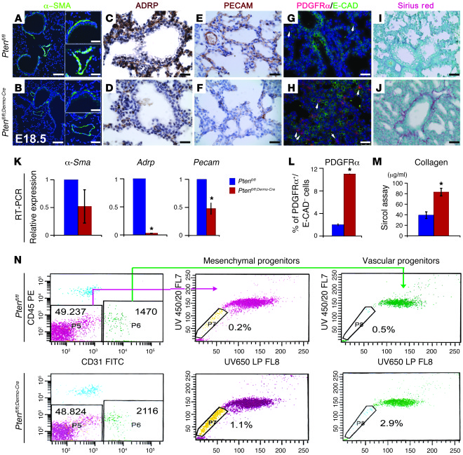 Arrested mesenchymal cell differentiation in Ptenfl/fl;Dermo-Cre lungs.
...