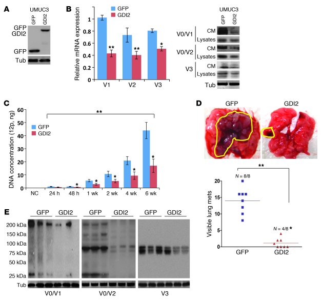 GDI2 overexpression reduces lung metastasis and VCAN expression.
(A) WBs...
