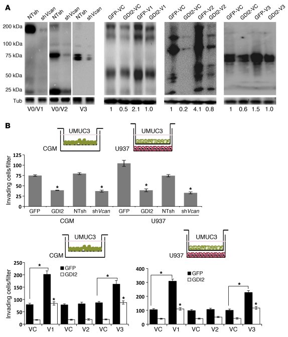 Effect of genetic manipulation of VCAN in UMUC3 cells on their in vitro ...