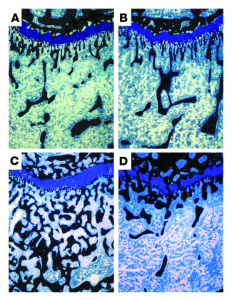 Histology of rat proximal tibia showing increased bone/osteoid accumulat...
