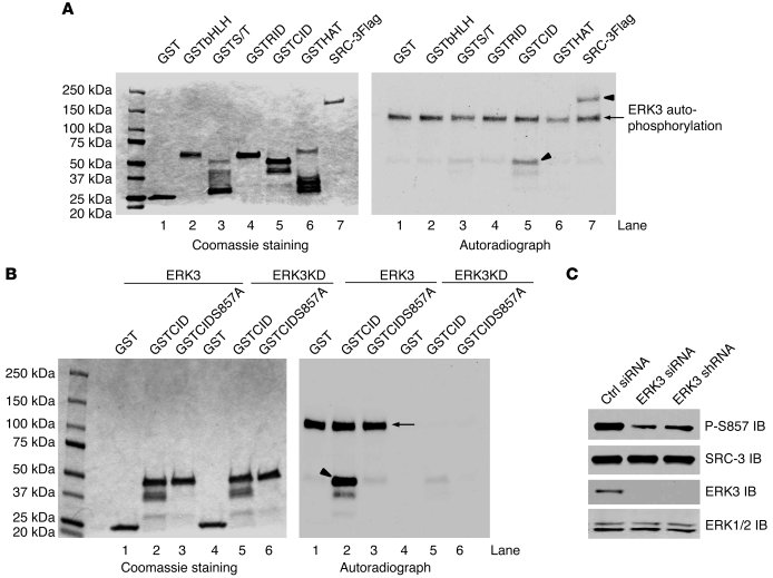 ERK3 phosphorylates SRC-3 at S857.
(A) ERK3 phosphorylates SRC-3 at the ...