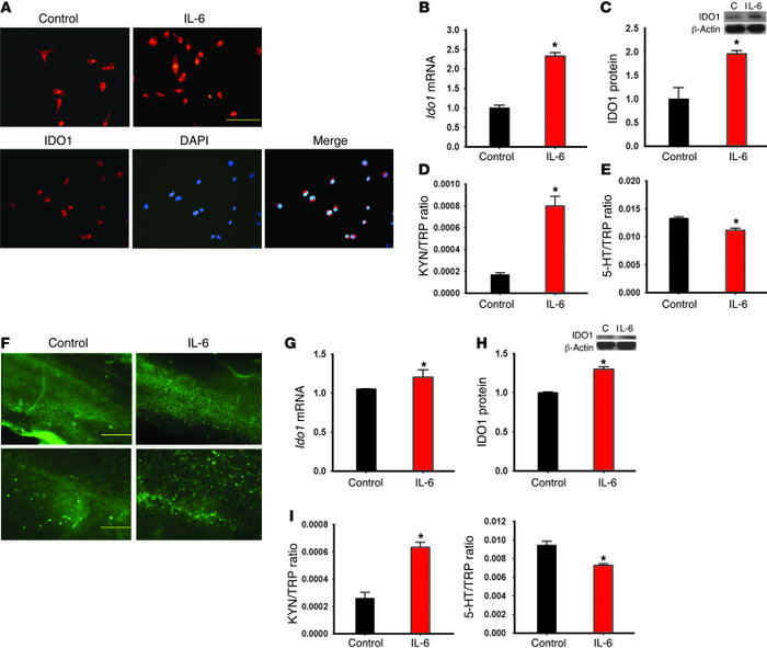 Effects of IL-6 on IDO1 expression in Neuro2a cells and organotypic hipp...