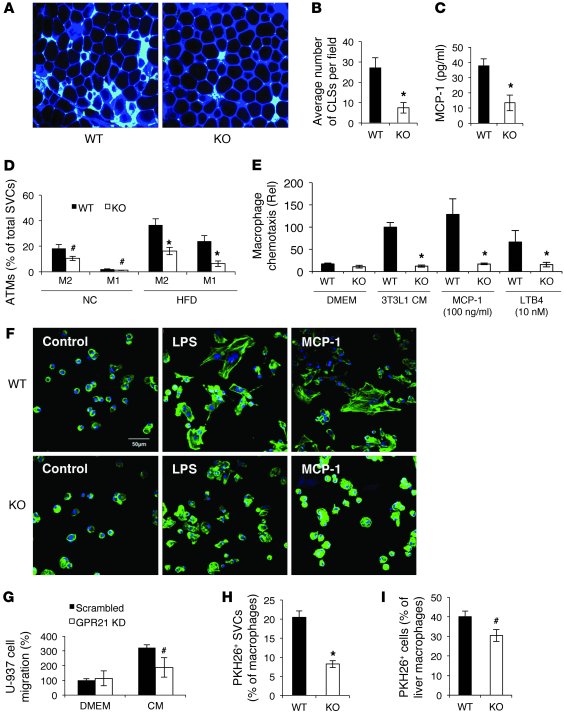 Decreased macrophages in adipose tissue of Gpr21 KO mice.
 
(A) Confocal...