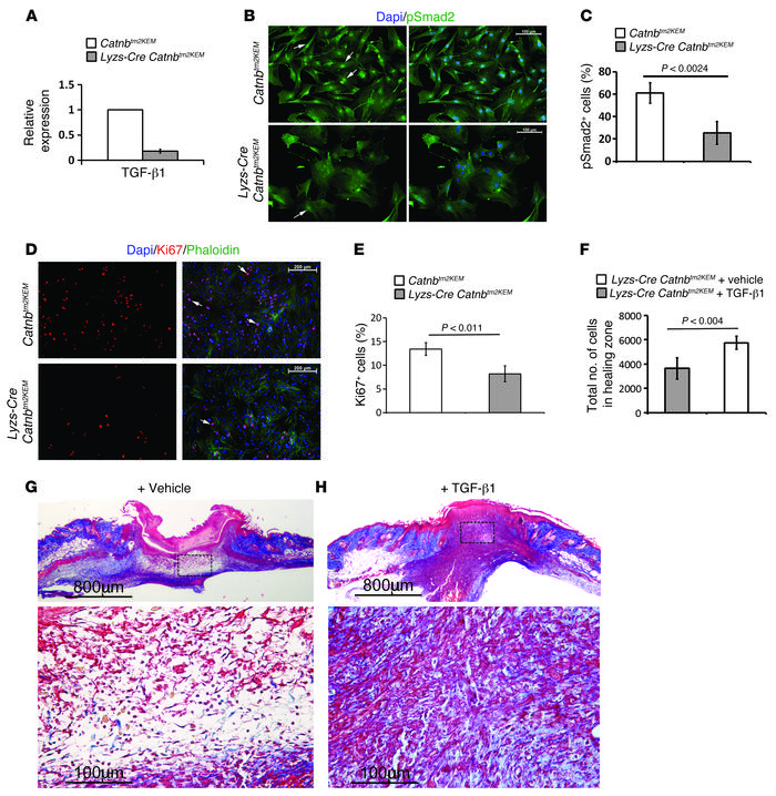 Macrophages lacking β-catenin induce less TGF-β1 signaling, and TGF-β1 p...