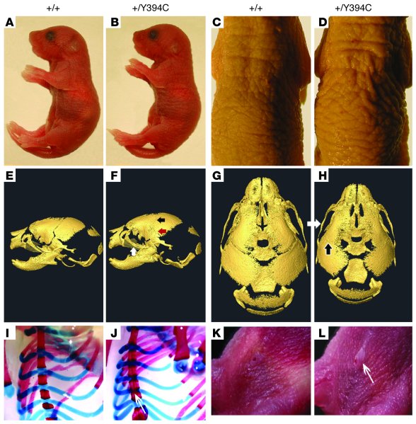 
Fgfr2+/Y394C mice have cutis gyrata, acanthosis, skull synostosis, and ...