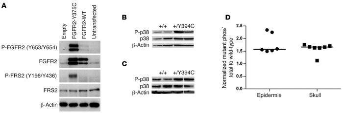 Constitutive activation of human FGFR2 Y375C in culture and increased ph...