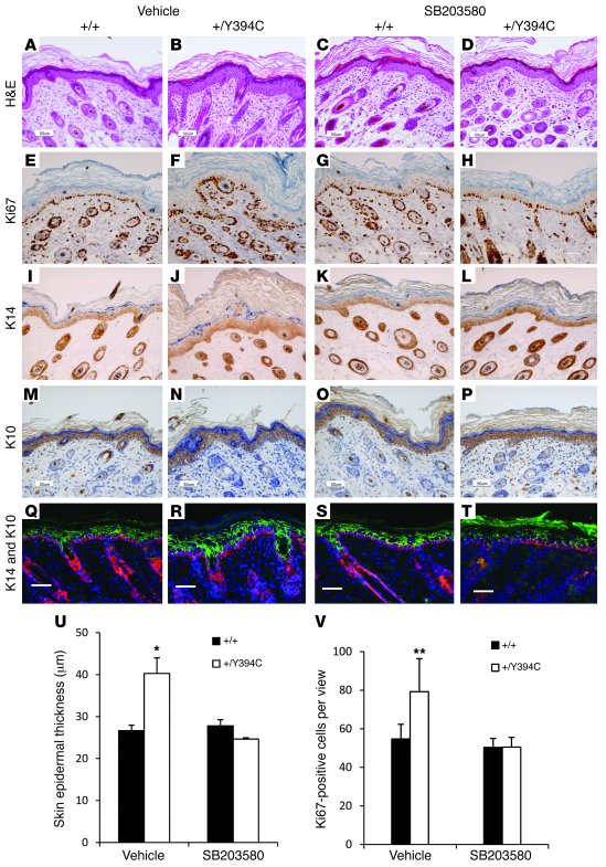 Topical p38 inhibition attenuates skin abnormalities in Fgfr2+/Y394C mic...