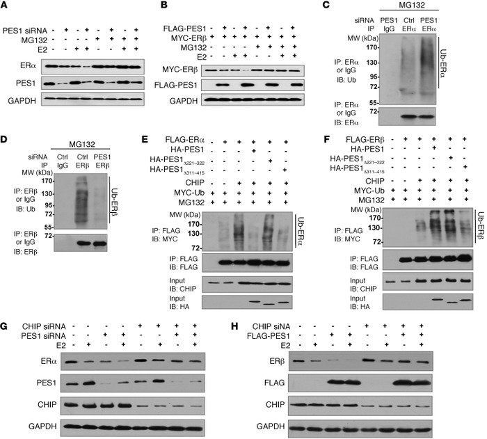 PES1 oppositely regulates ERα and ERβ stability through the CHIP-mediate...