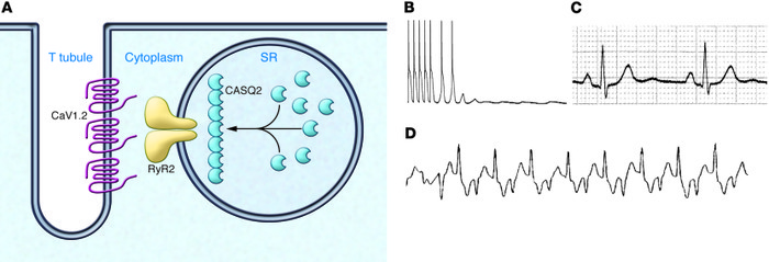 CPVT.
(A) Subcellular localization of the calcium-handling proteins invo...