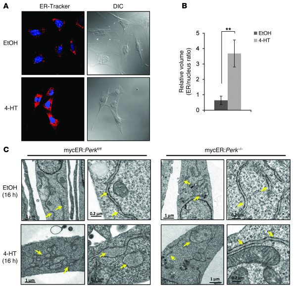 c-Myc expression induces PERK-dependent ER expansion.
(A) mycER:Perkfl/f...