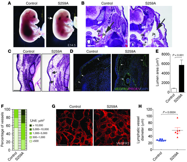 Endothelial-specific expression of RAF1S259A induces enlarged lymphatic ...