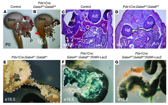 Pancreas-specific deletion of Gata4 and Gata6 causes pancreatic agenesis...