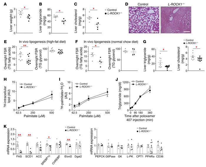 Loss of ROCK1 decreases hepatic lipid accumulation by reducing de novo l...