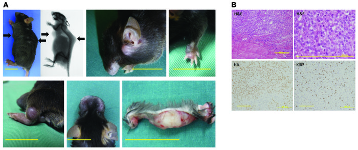 
EWS/ATF1-induced tumors resemble human CCS.
 
EWS/ATF1 transgenic mice ...