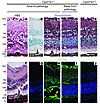 Retinal hypoxia in Cyp27a1–/– mice.