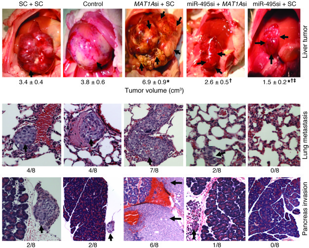 Role of MAT1A in tumorigenesis and therapeutic effect of miR-495 siRNA.
...