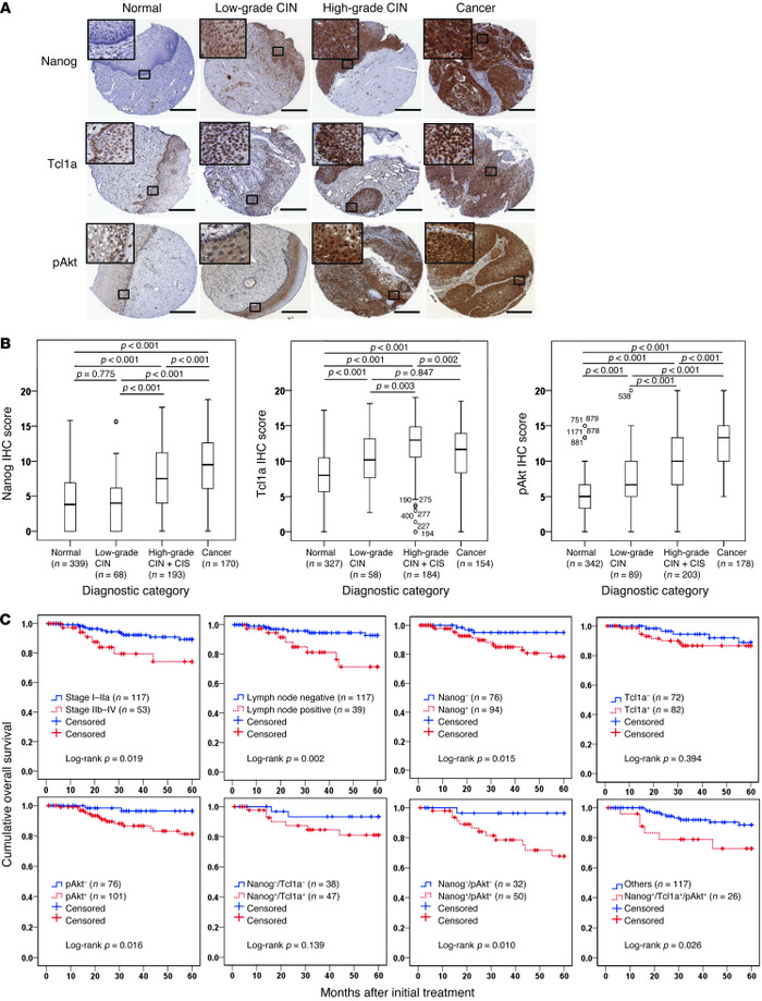 Nanog expression in human cervical neoplasia specimens correlates with s...