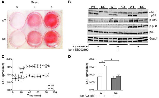 Cell autonomous effect of p62 on mitochondrial function in BAT primary c...