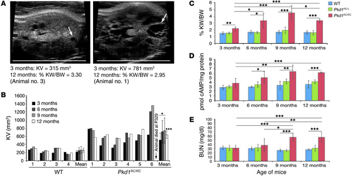 Homozygosity of the Pkd1 p.R3277C allele results in progressive PKD with...