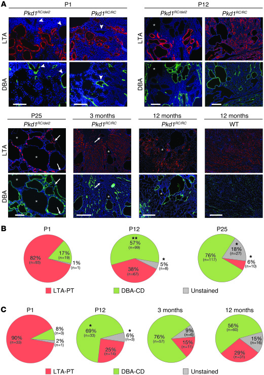 
Pkd1 p.R3277C mice show a switch in tubular cyst origin corresponding t...