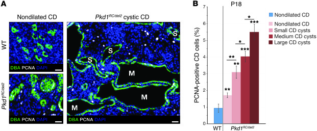 Cystogenesis of Pkd1RC/del2 mice is associated with an increase in proli...