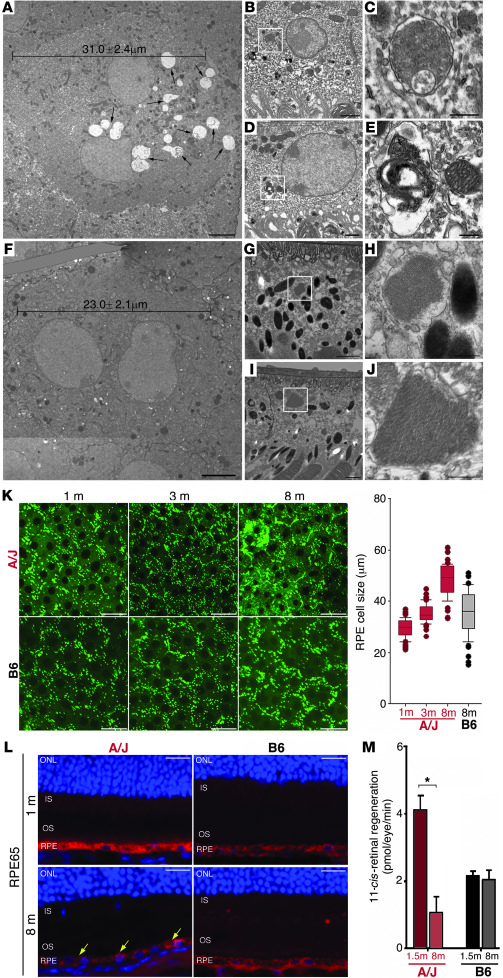 Substantial pathological changes are apparent in RPE cells of A/J mice b...