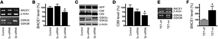 GSK3β, but not GSK3α, regulates BACE1 gene expression and APP processing...