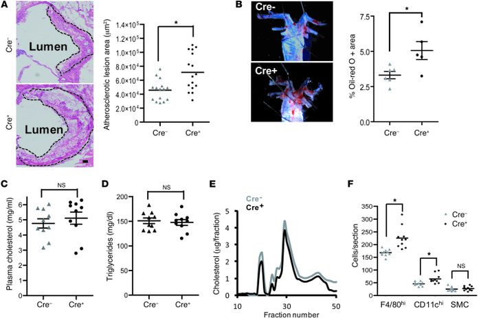 Atherosclerosis is increased in WD-fed Ldlr–/– mice transplanted with bo...