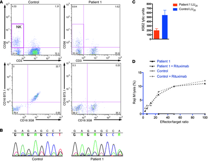 Point mutation in CD16 results in CD16 B73.1 epitope loss and decreased ...