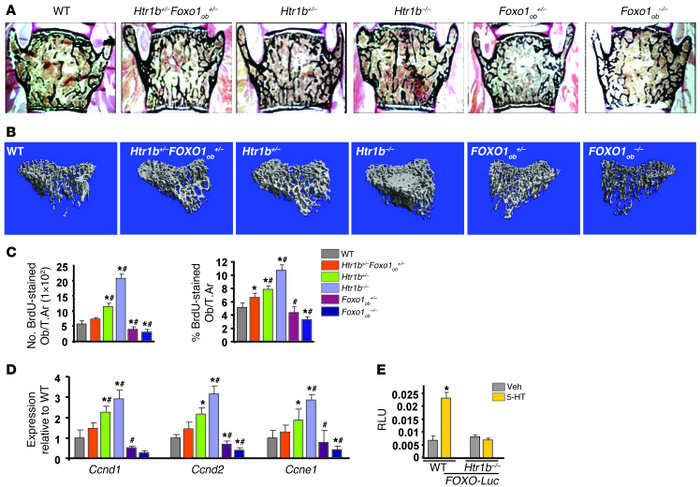 Serotonin regulates FOXO1 transcriptional activity via its HTR1B recepto...