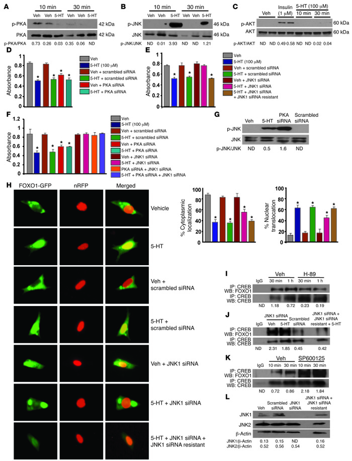 PKA/JNK1-dependent signaling localizes FOXO1 to the nucleus.
Immunoblot ...