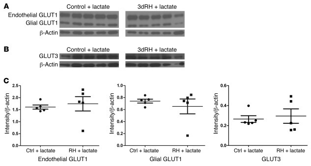 Glucose transporter expression levels in protein extracts from the brain...