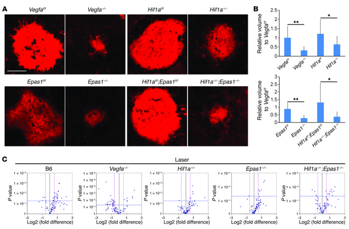 Attenuated angiogenic gene regulation in pathological states of Vegfa co...