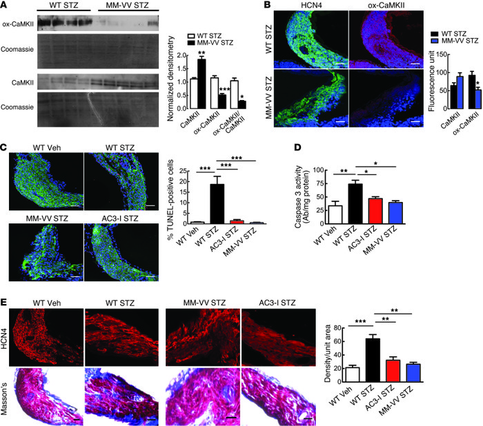 Oxidation-resistant CaMKII and myocardial CaMKII inhibition protects aga...