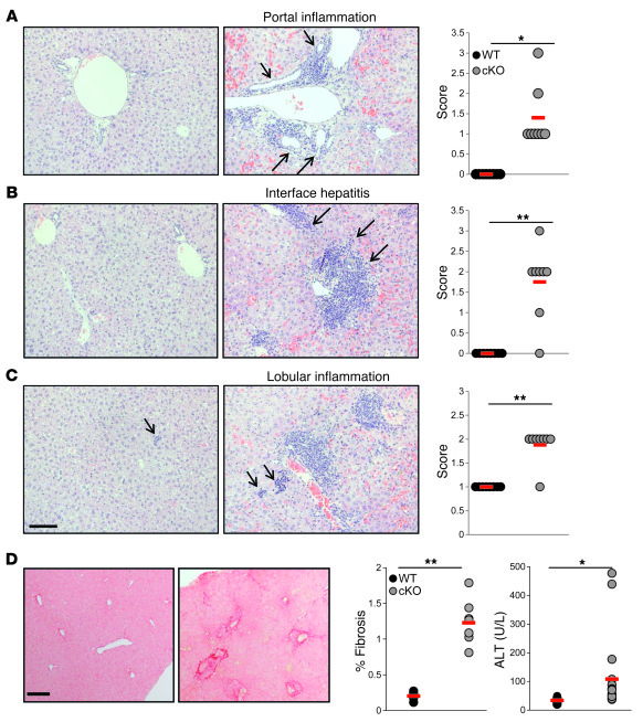 Liver inflammation in Traf6ΔTEC mice exhibits pathognomonic features of ...