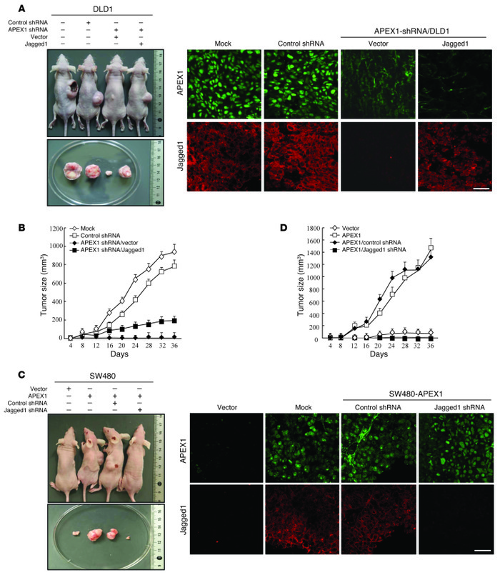 APEX1 regulates tumor growth through Jagged1 in a mouse model.
(A and B)...