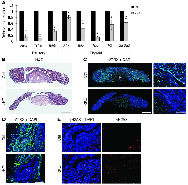 Loss of ATRX in the developing anterior pituitary causes DNA damage, red...