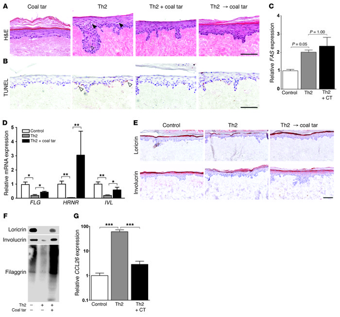 Coal tar attenuates Th2 cytokine–induced AD hallmarks.
(A) H&amp;E stain...