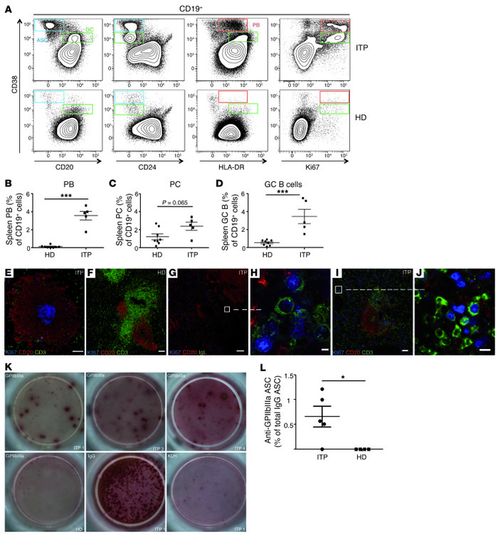 Spleen in ITP is the site of an active B cell response producing anti-Gp...