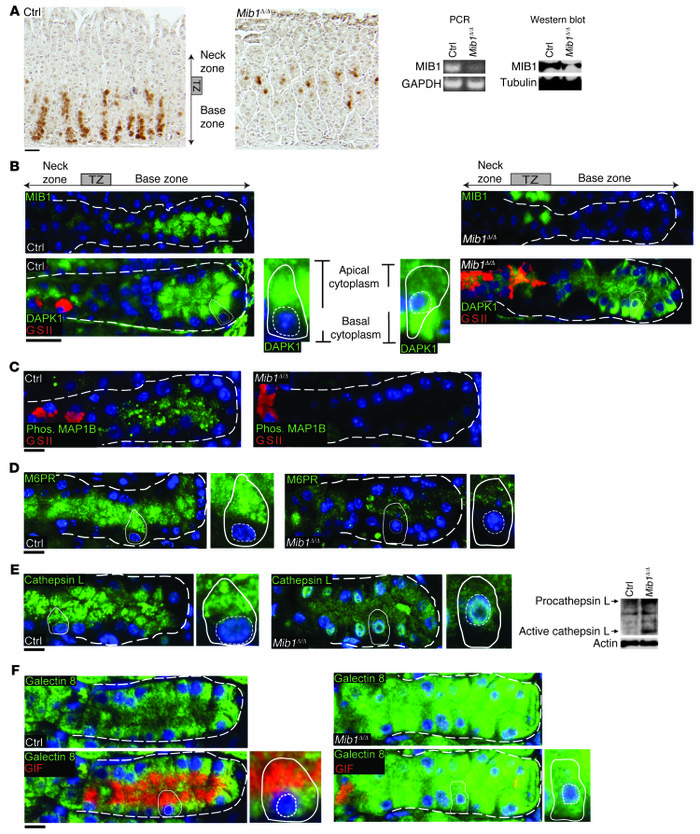 MIB1 maintains apical compartment physiology by regulating the subcellul...