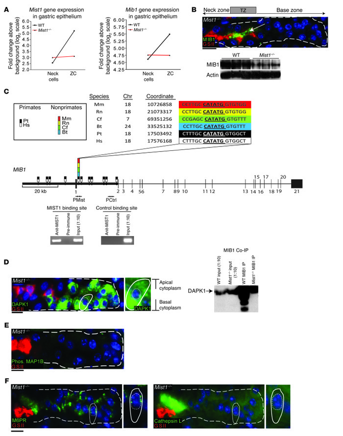 MIST1 regulates MIB1 expression during ZC differentiation.
(A) Microarra...