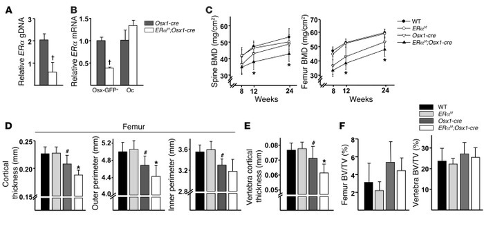 Deletion of ERα in Osx1-cre–expressing cells decreases cortical bone mas...