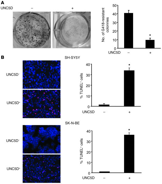 UNC5D inhibits cell growth and induces apoptosis in NB cell lines.
(A) C...