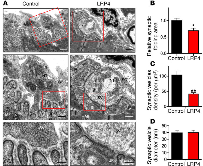Abnormal NMJ ultrastructure in LRP4-injected mice.
(A) Representative el...