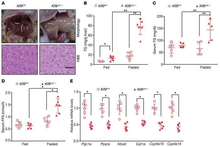 Liver-specific Klf9-deficient mice display fasting-induced hepatic steat...