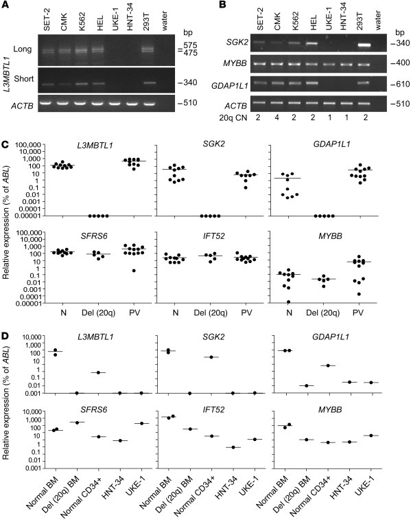 Expression of imprinted genes is lost in hematopoietic cells carrying th...