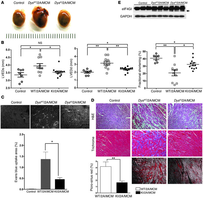 Prevention of dystrophin cleavage in DysKI/2A/MCM mice inhibits enterovi...