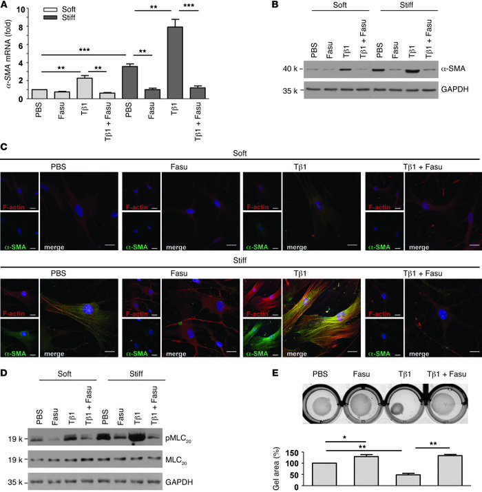 Fasudil inhibits lung fibroblast-to-myofibroblast differentiation in res...