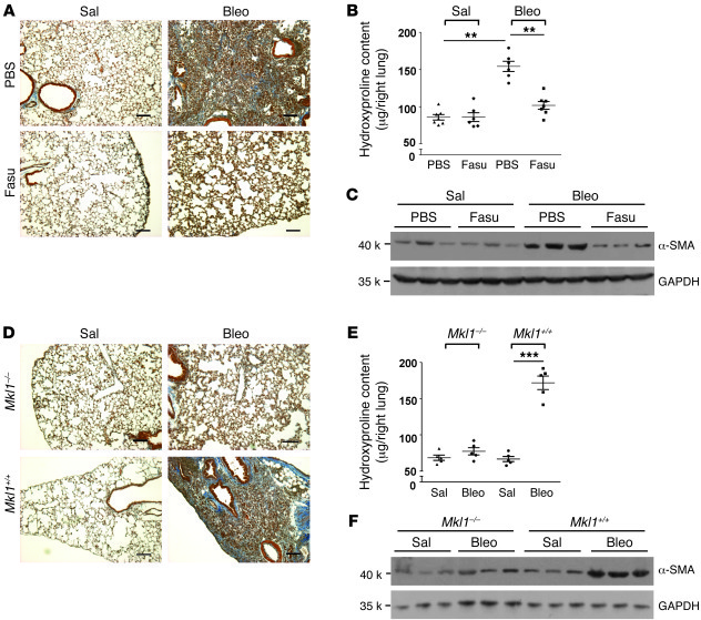 Postinflammatory treatment with fasudil or genetic deletion of Mkl1 prot...